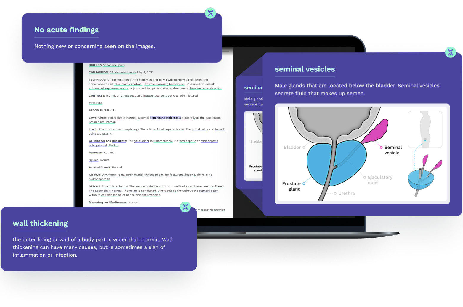 Imaging reports powered by Scanslated