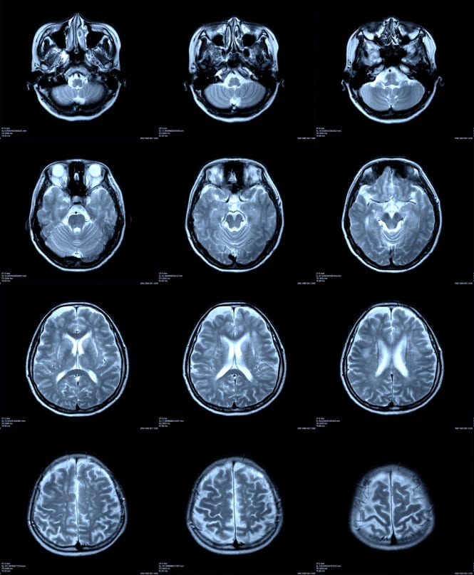 Private Full Body MRI Scans