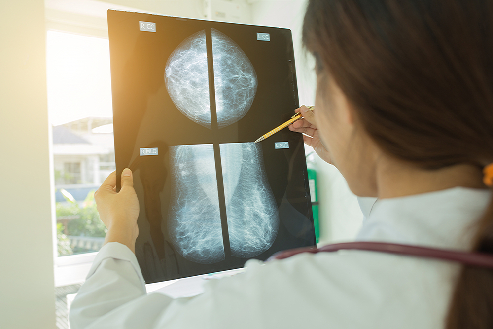 Book a private Mammogram scan near you